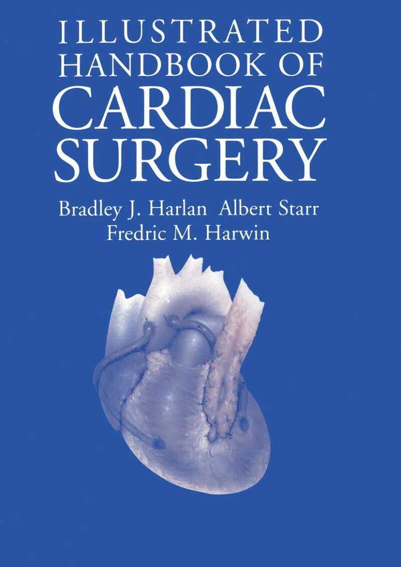 Illustrated Handbook of Cardiac Surgery (Applied Mathematical Sciences; 109)