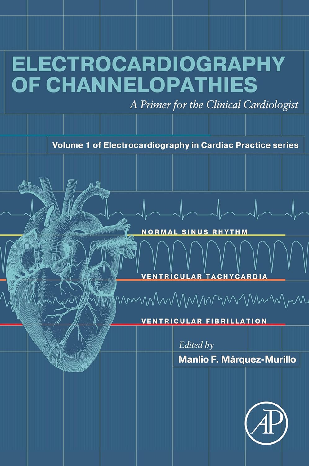 Electrocardiography of Channelopathies: A Primer for the Clinical Cardiologist (Electrocardiography in Cardiac Practice)