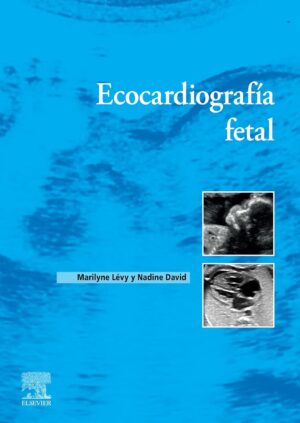 Ecocardiografía fetal
