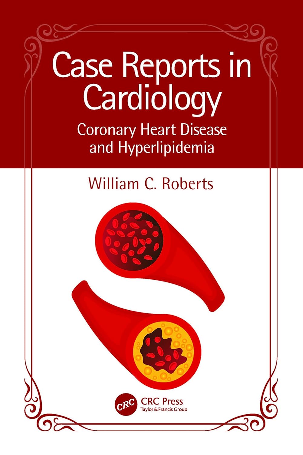 Case Reports in Cardiology: Coronary Heart Disease and Hyperlipidemia (Original PDF from Publisher)
