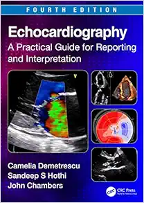 Echocardiography: A Practical Guide for Reporting and Interpretation, 4th Edition (Original PDF from Publisher)