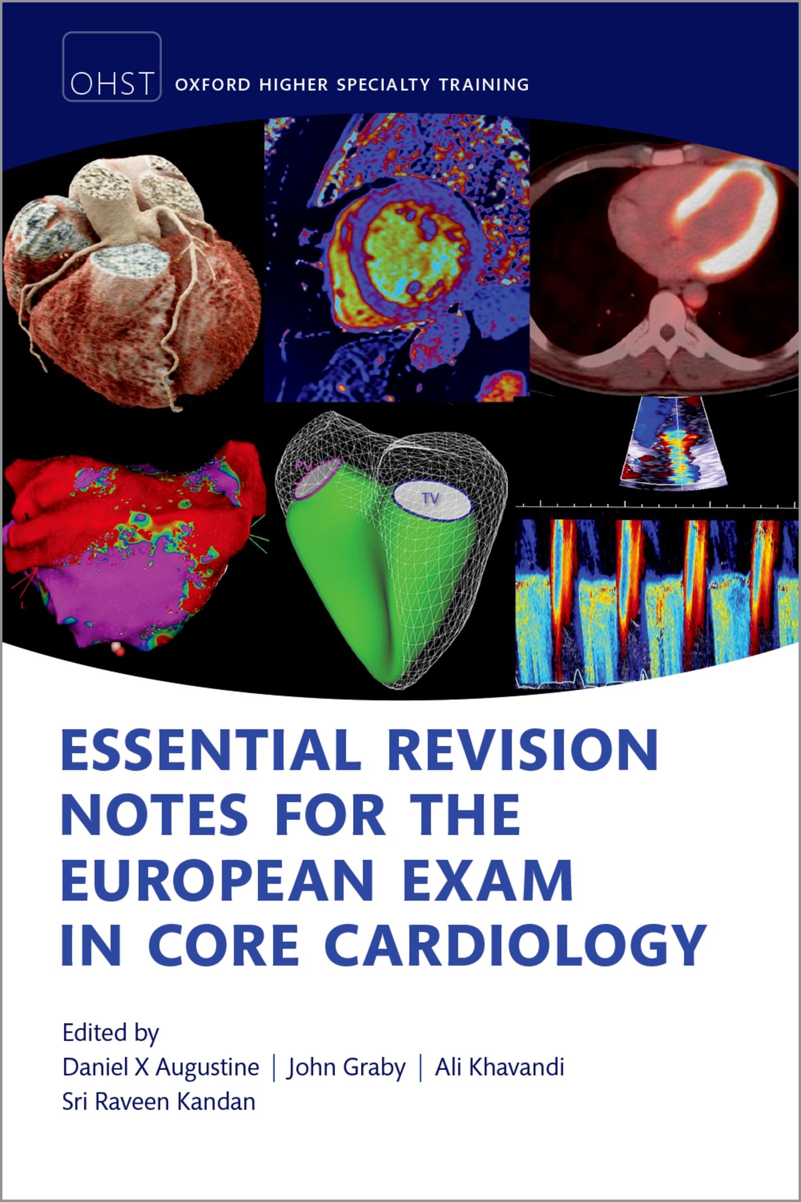 Essential Revision notes for the European Exam in Core Cardiology, 2nd Edition (Original PDF from Publisher)
