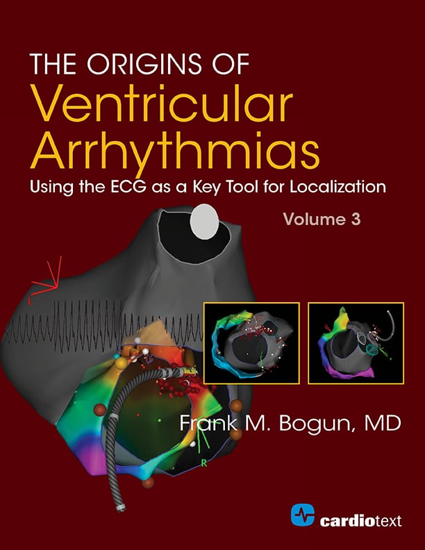 The Origins of Ventricular Arrhythmias: Using the ECG as a Key Tool for Localization, Volume 3 (Original PDF from Publisher)