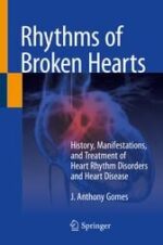 Rhythms of Broken Hearts : History, Manifestations, and Treatment of Heart Rhythm Disorders and Heart Disease (Original PDF from Publisher)