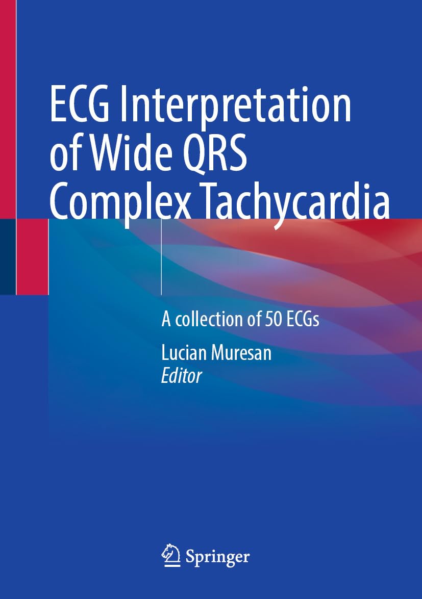 ECG Interpretation of Wide QRS Complex Tachycardia: A collection of 50 ECGs (Original PDF from Publisher)