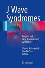 J Wave Syndromes: Brugada and Early Repolarization Syndromes (Original PDF from Publisher)
